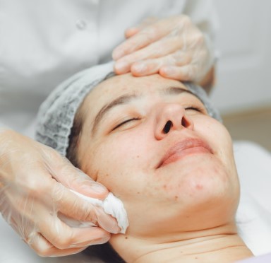 Limpieza facial